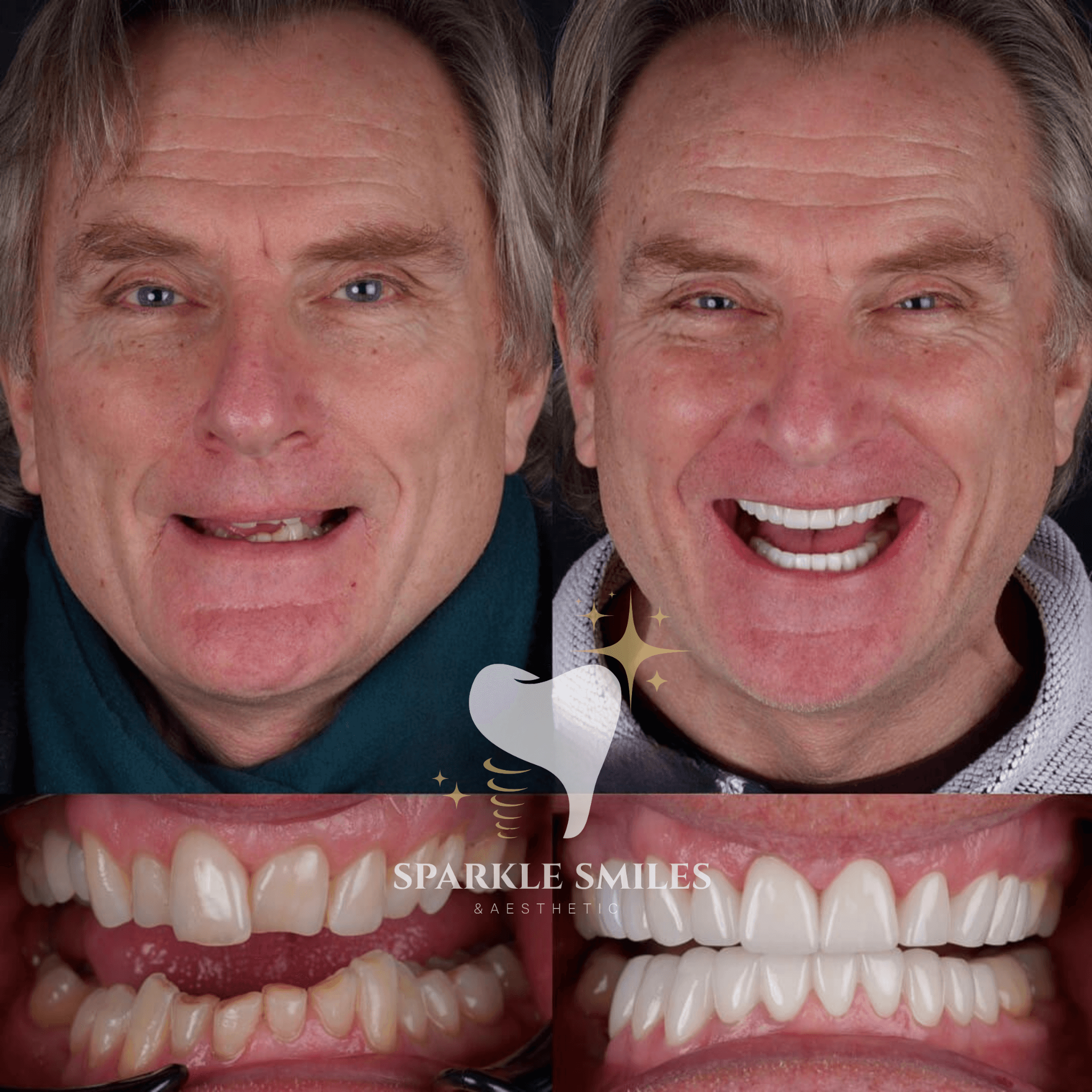 Естественный вид