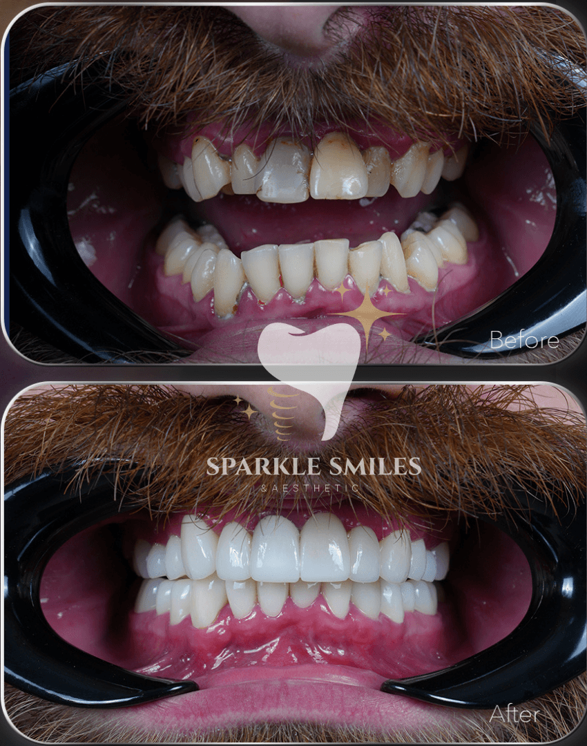 Тонкие и изящные