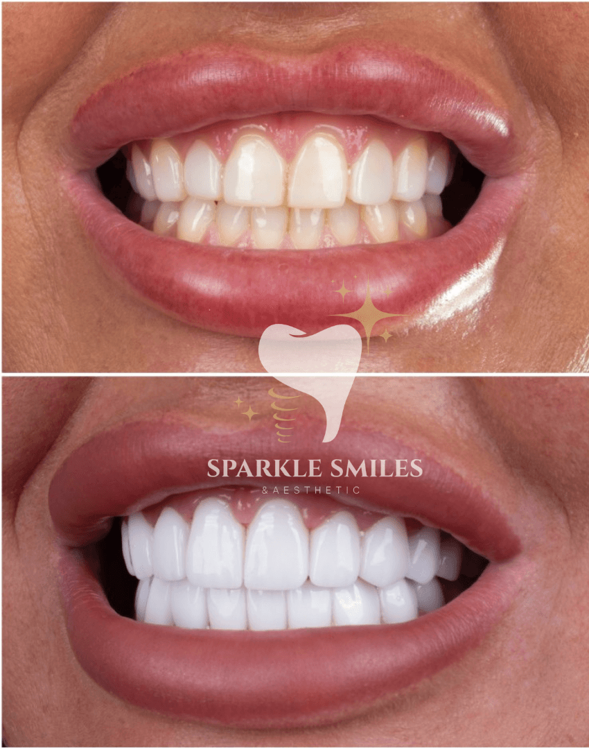 Быстрое и эффективное решение