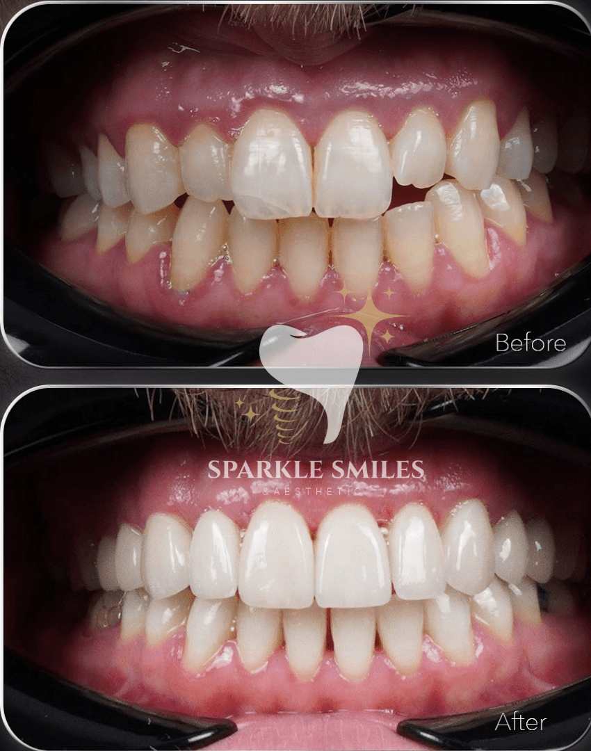 Индивидуальный дизайн