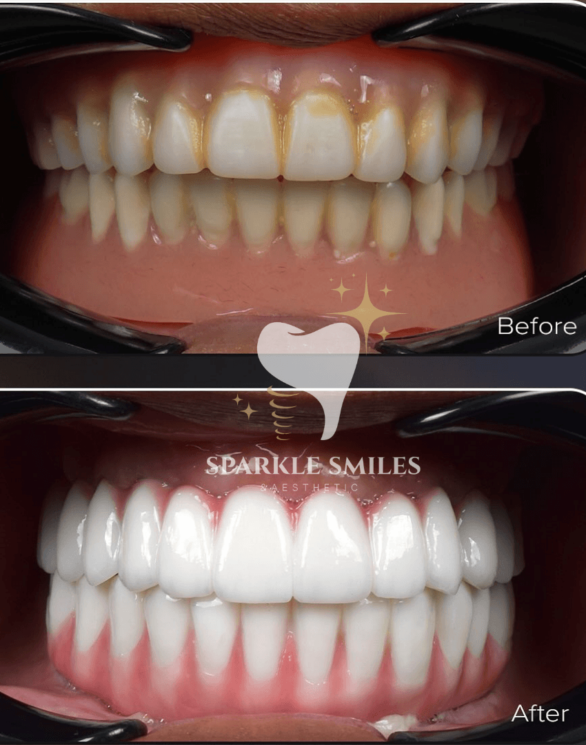 gallery.item14.title