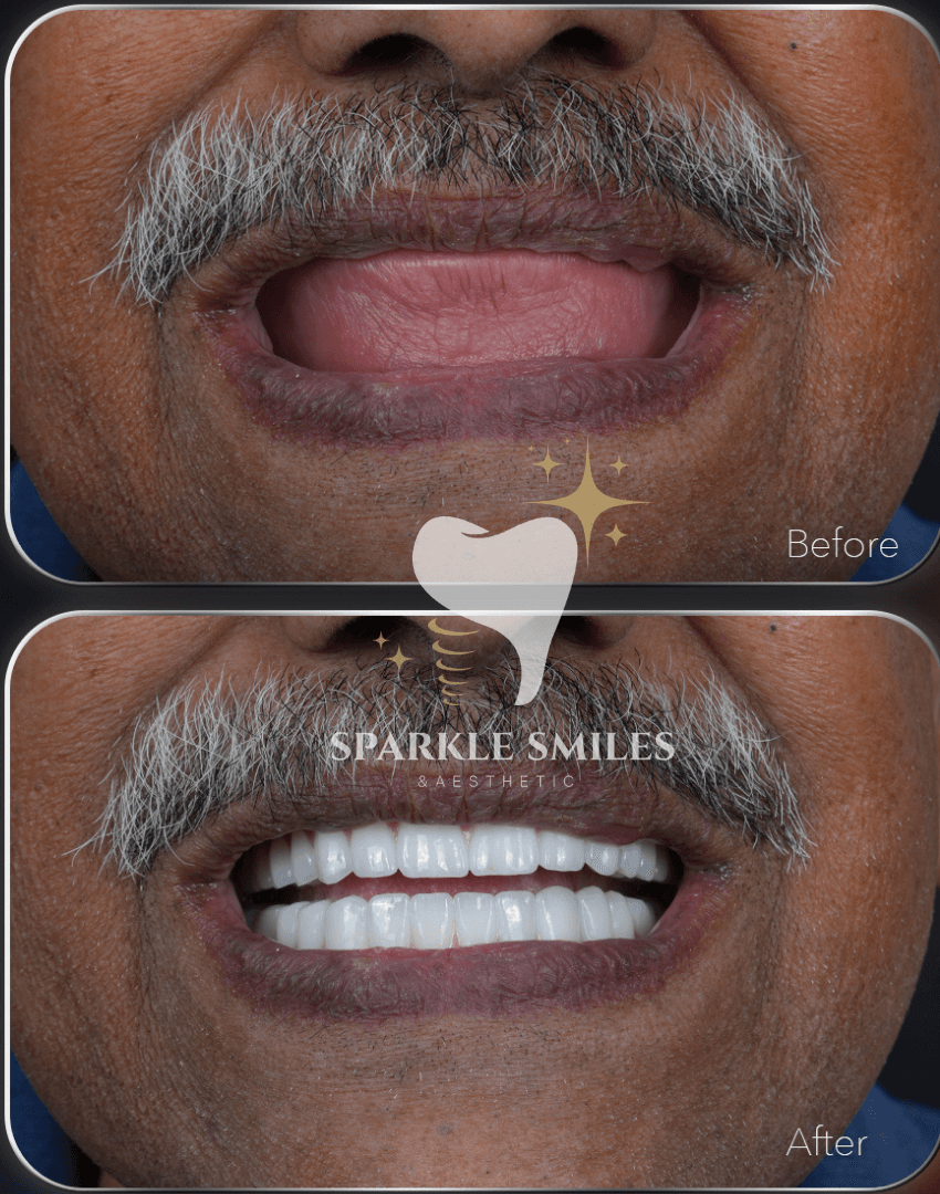 gallery.item15.title