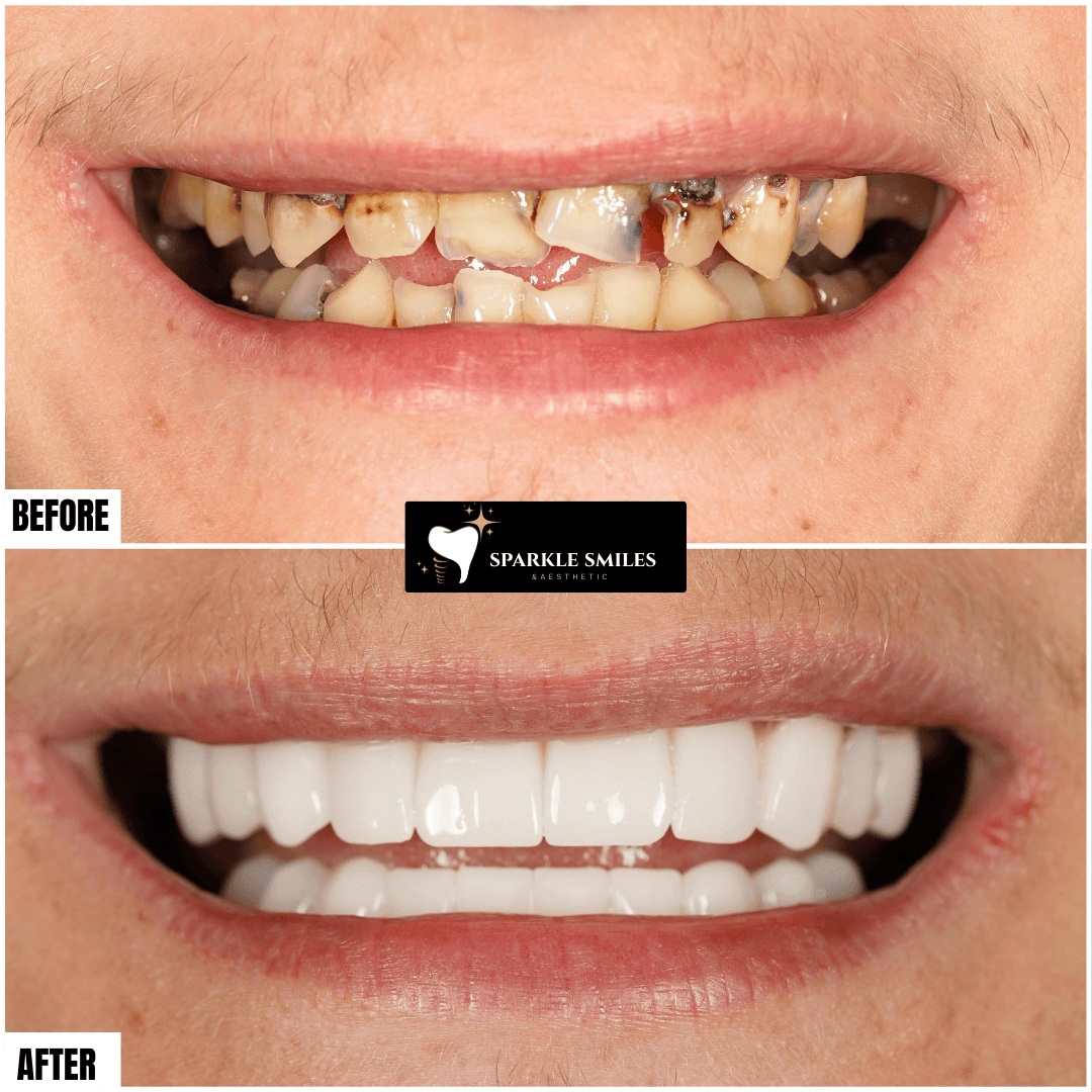 gallery.item16.title