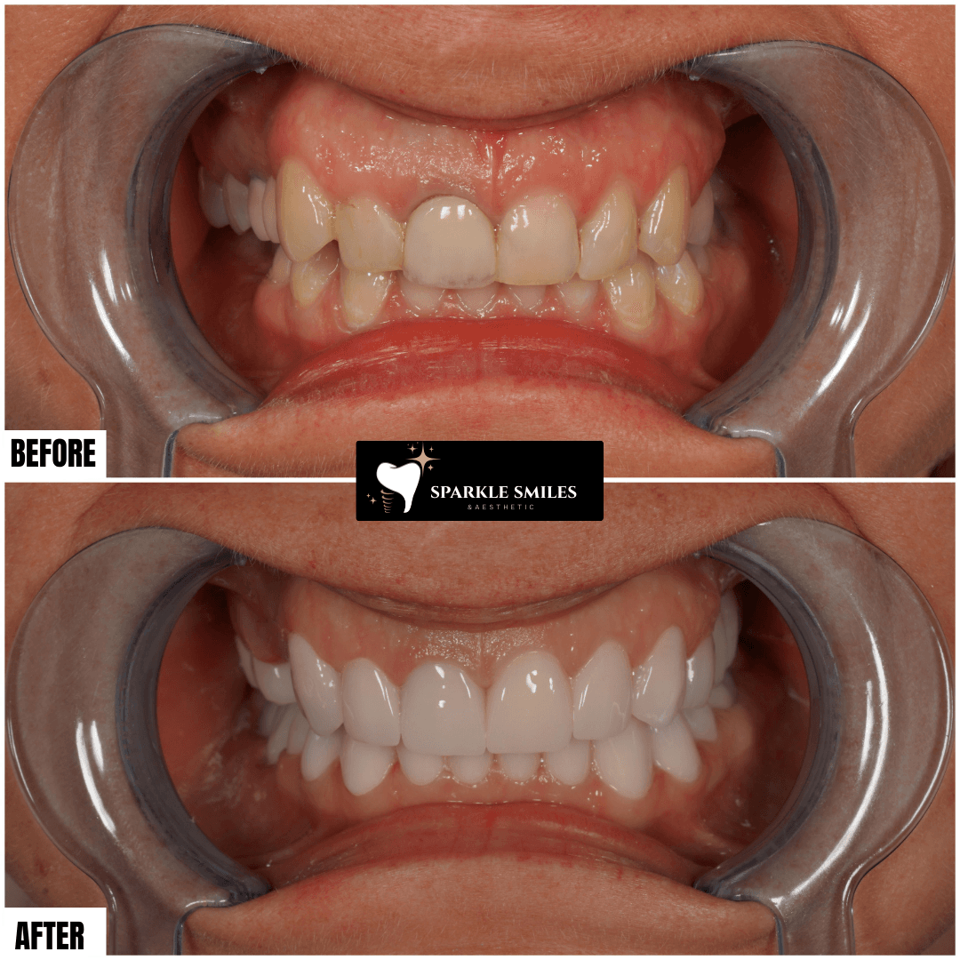 gallery.item17.title