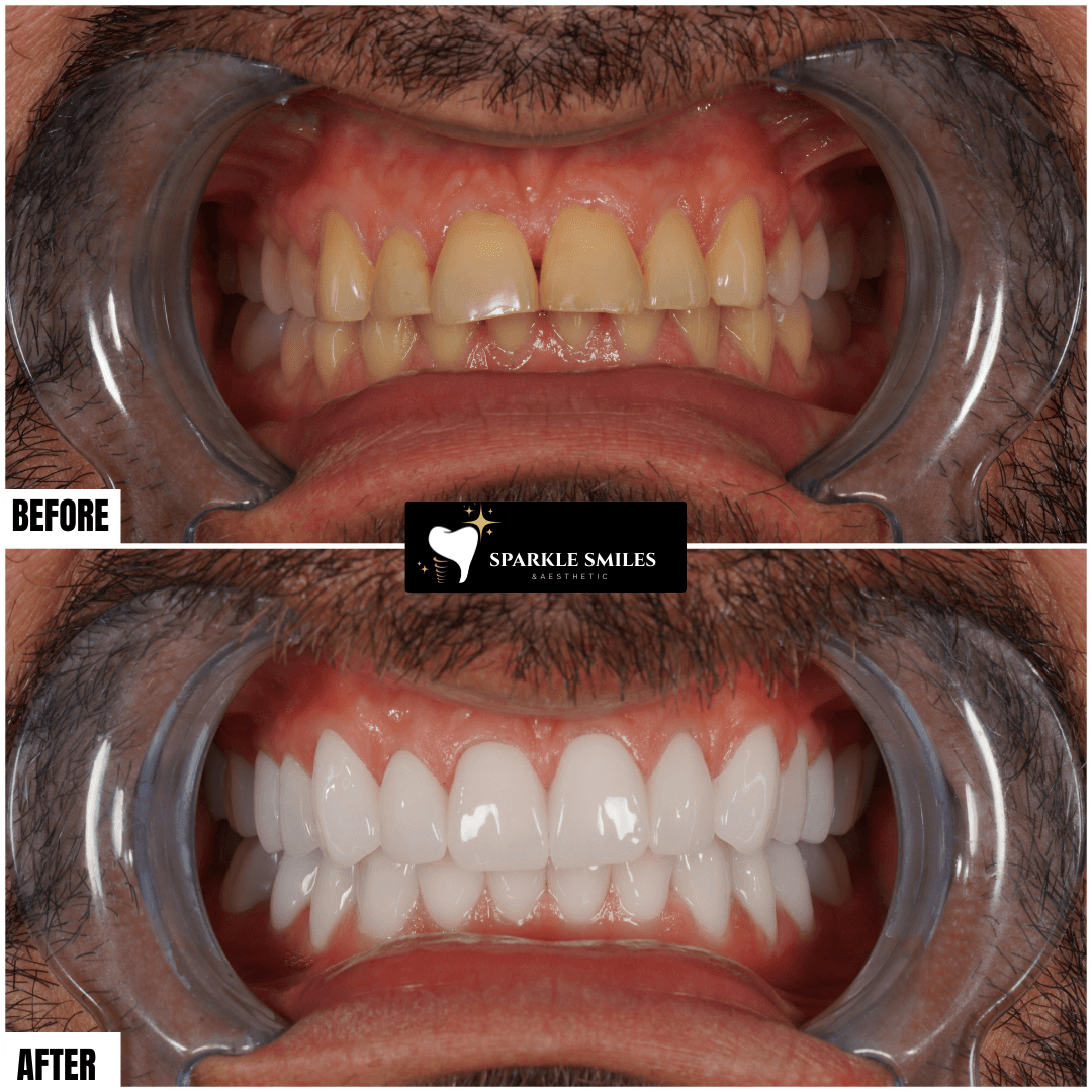 gallery.item18.title