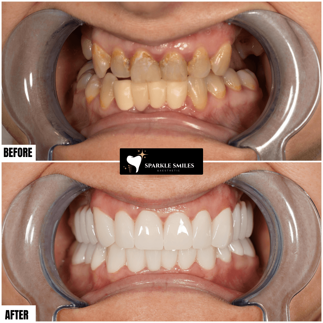 gallery.item19.title