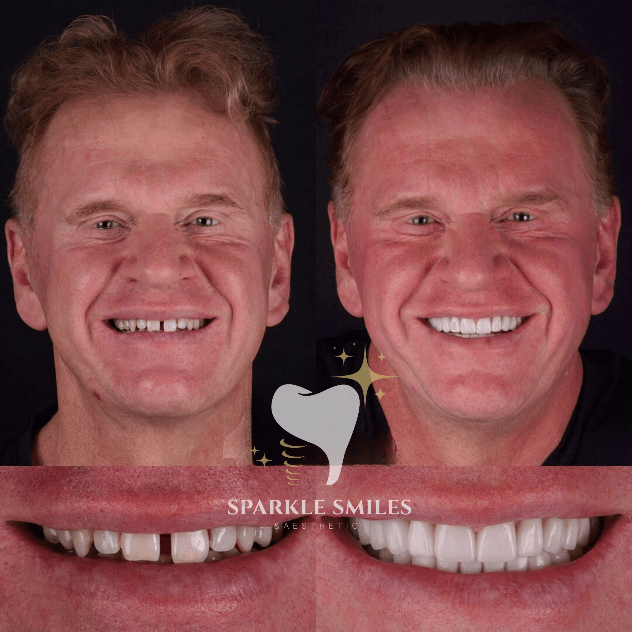 Естественная белизна