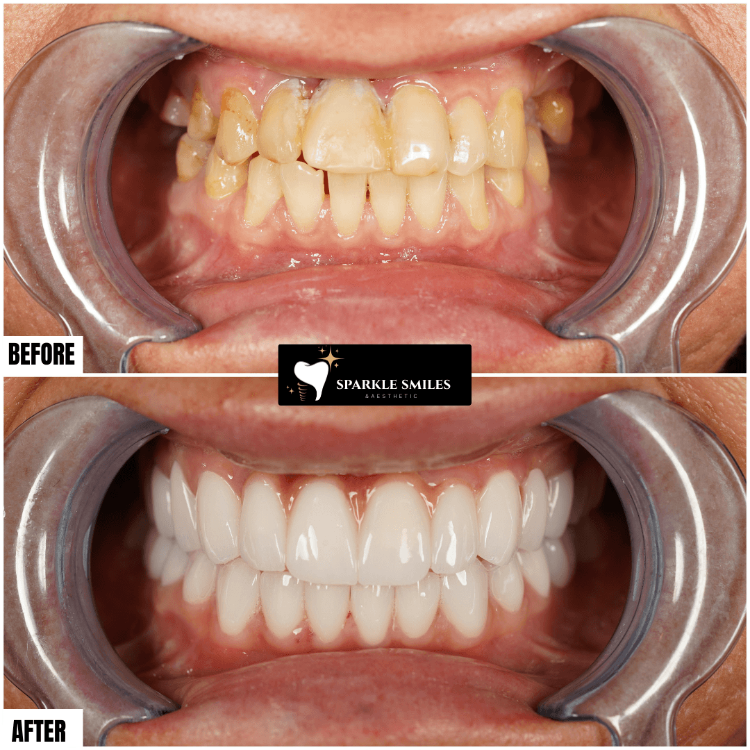 gallery.item20.title