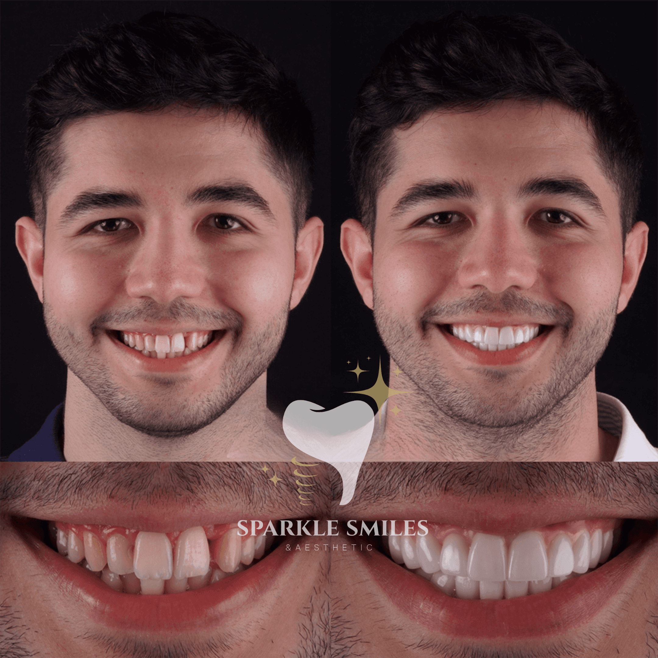 Полное восстановление полости рта