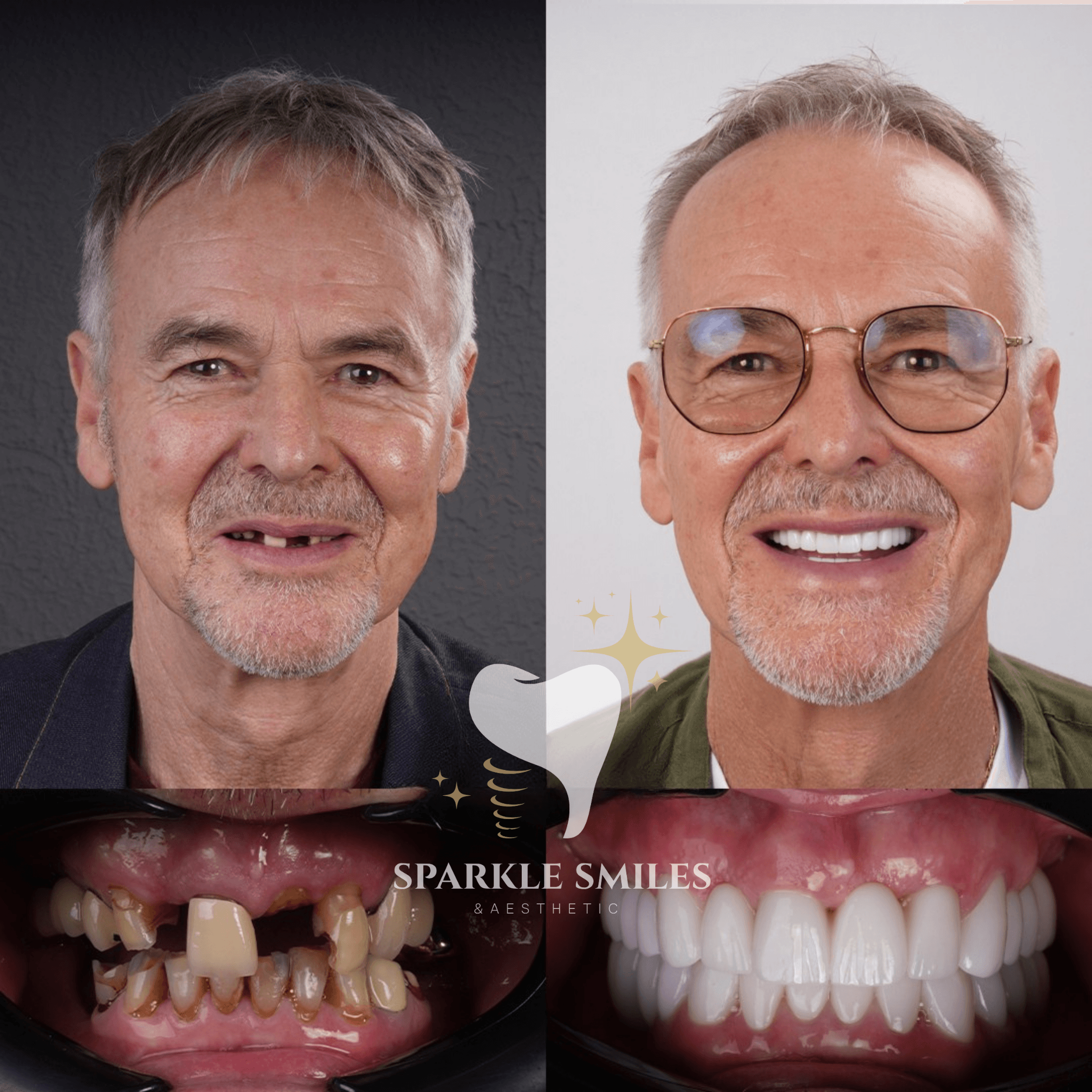 Идеальное соответствие