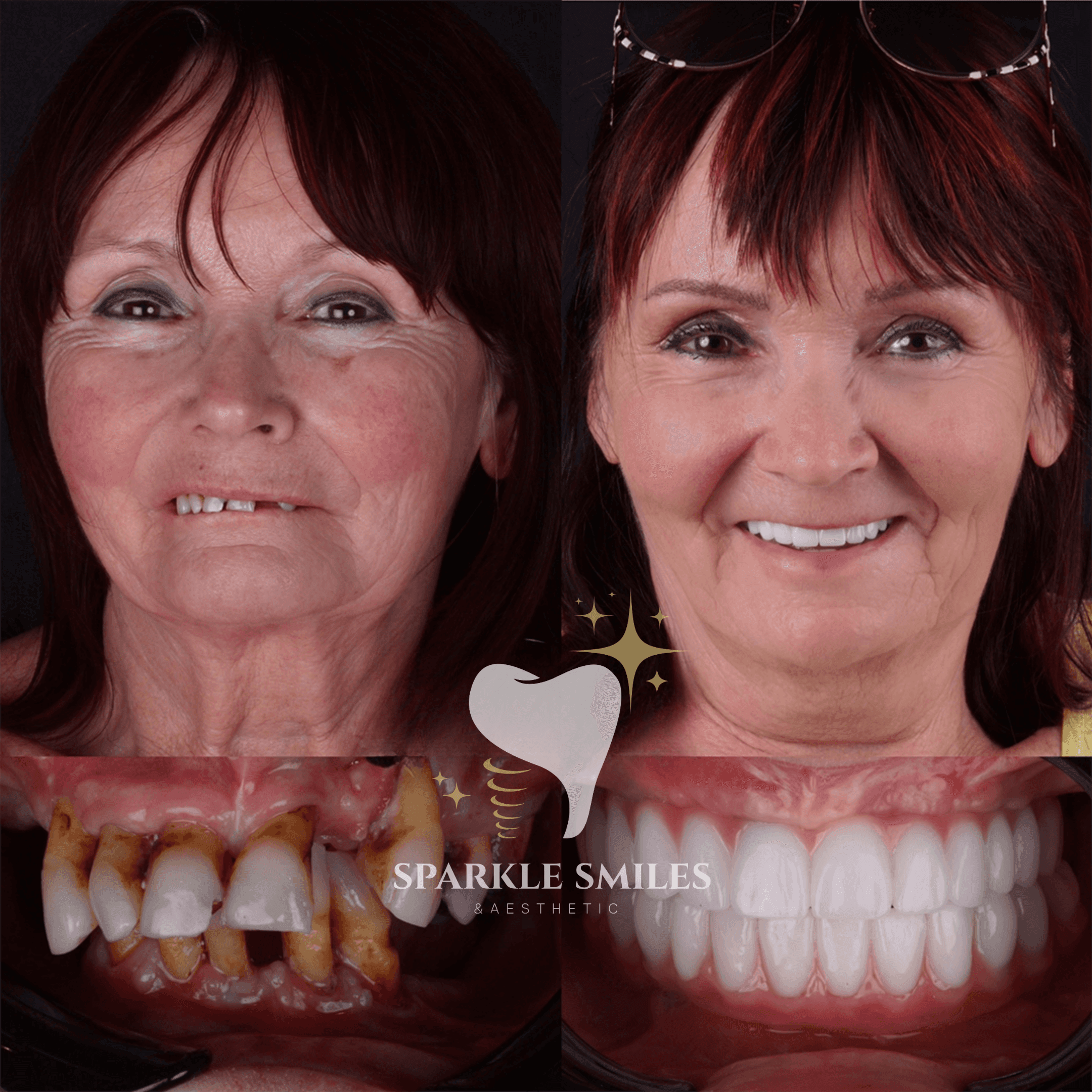 Блестящие результаты