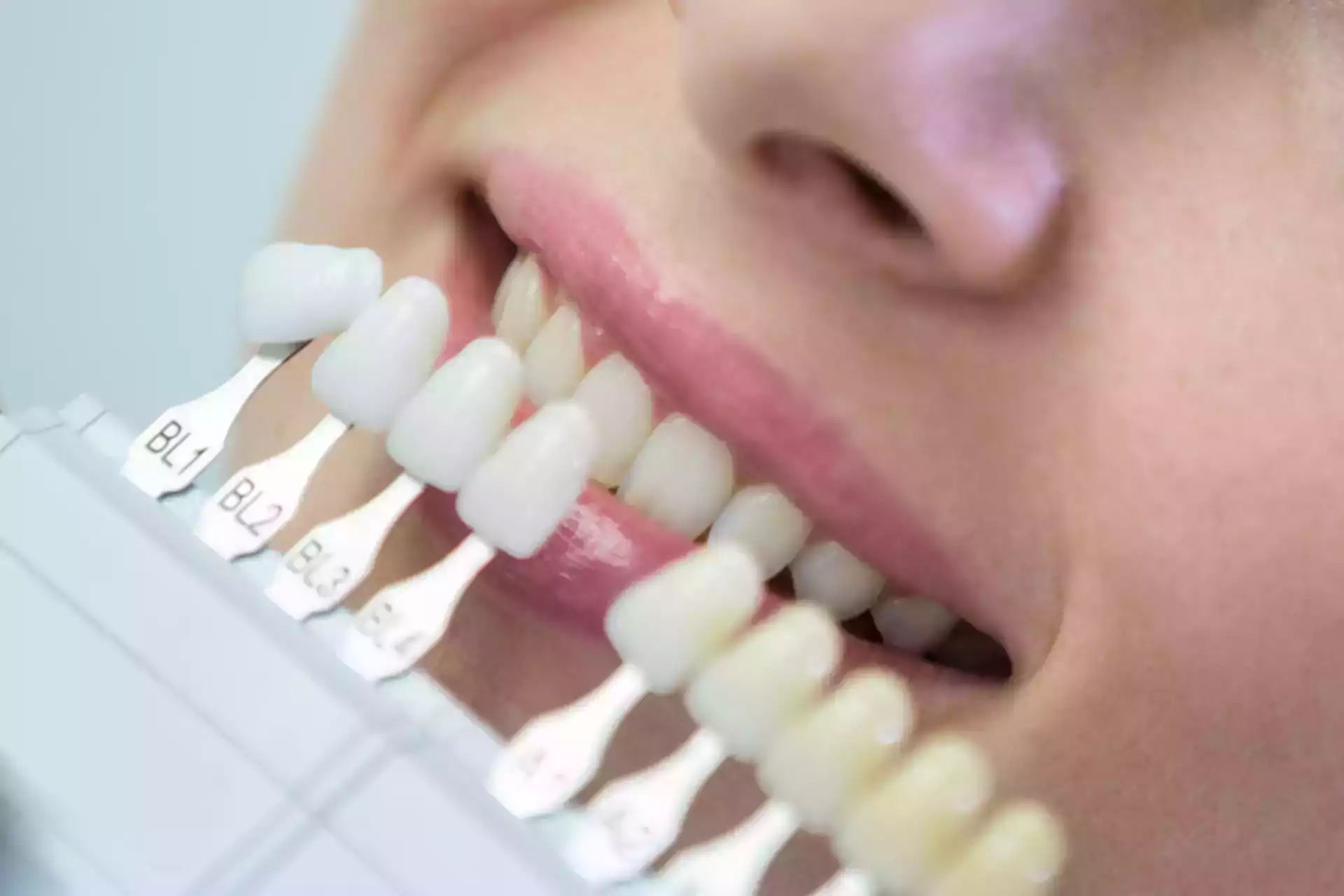 Veinearan Lannaichte